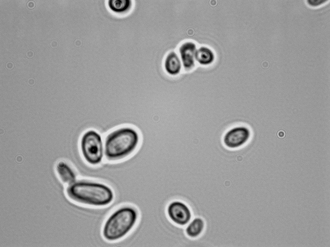 Candida parapsilosis deals